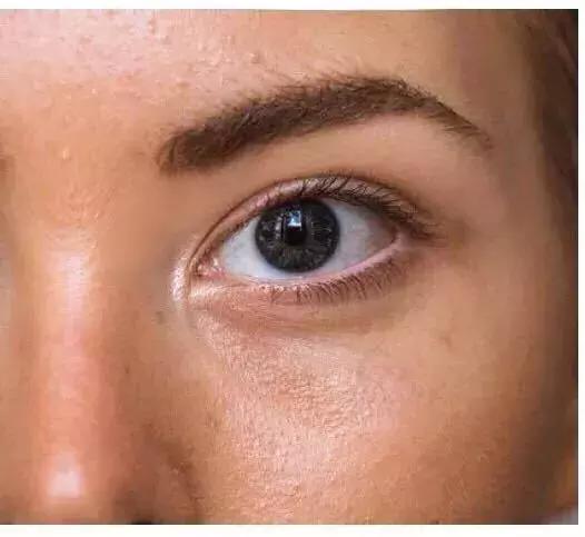 吸黑头神器去粉刺角质收缩毛孔,皮肤清洁收缩毛孔黑头角质