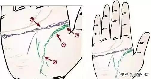 手诊图大全清晰图手背,全息手诊图