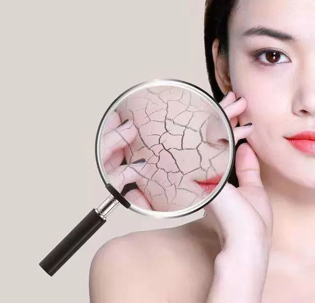 绵羊油是都是绵羊的油吗,绵羊油对应成分羊毛脂