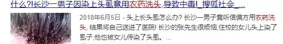 女孩头上长虱子外婆竟用敌敌畏给外孙女洗头，医生提醒来了