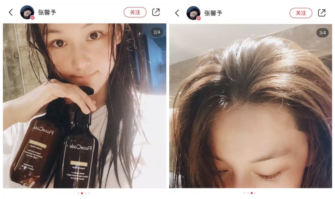 明星护发防掉发秘籍,明星发量增多的秘诀