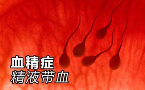 为什么男性精子颜色偏黄,为什么男性有些精子淡红色