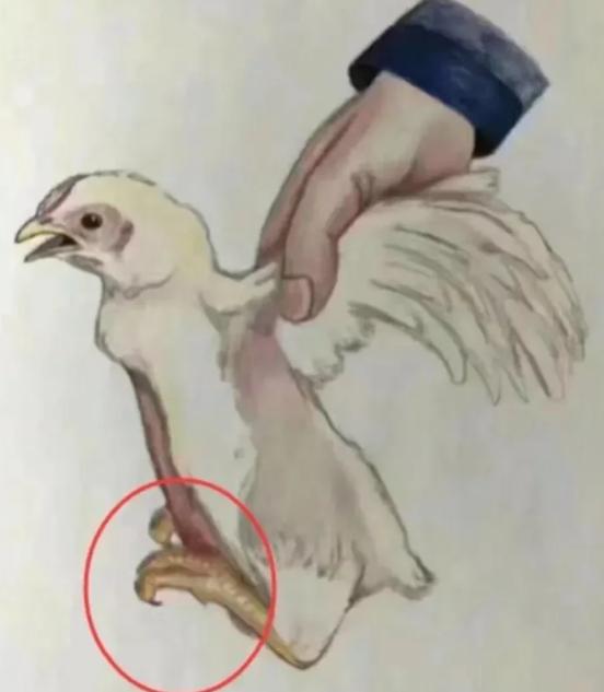 高发腺肌胃炎的症状,最常见慢性胃炎临床表现