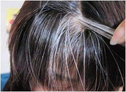 很年轻却有白头发怎么办,39岁毛发变白越来越多是什么原因