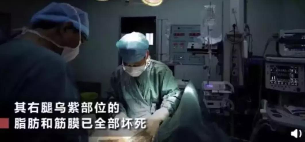 孕妇被蚊子咬了怎么止痒消肿,蚊子咬了止痒消肿最快的办法