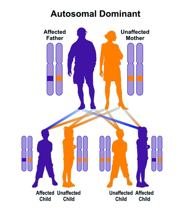 全身内外都是瘤子是什么病,全身长满瘤子怎么治疗