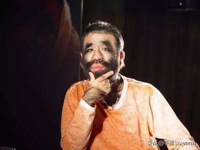 全世界体毛最多的人，是如何在歧视中逆袭为实力派歌手的？