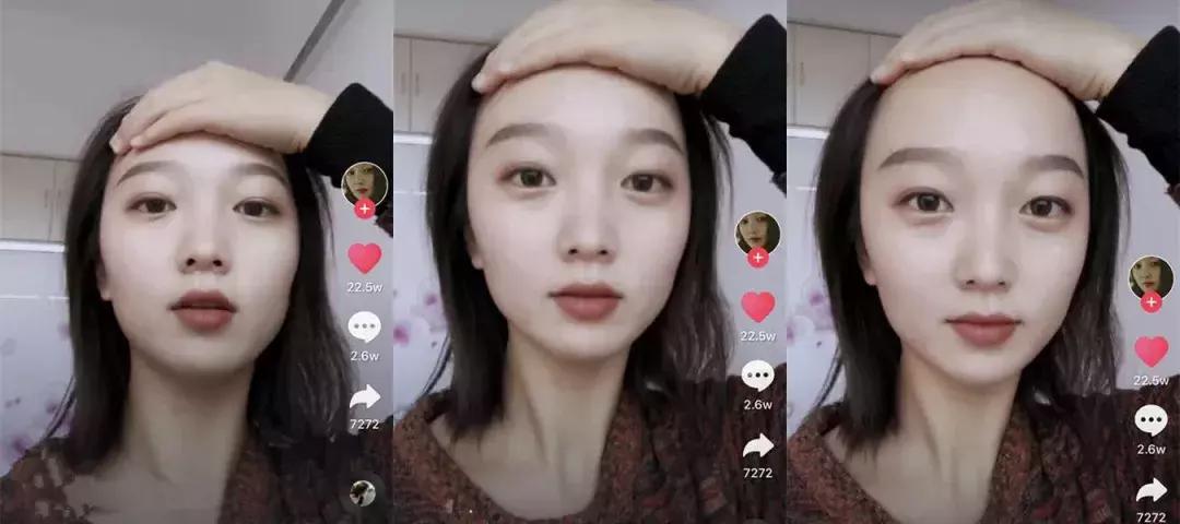 头发毛躁并且脱发推荐洗发水,用什么洗发水改善头皮脱发