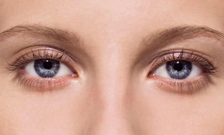 割了双眼皮怎么预防疤痕增生,双眼皮眼角增生疤痕能自愈吗