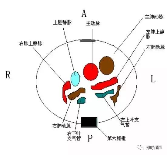 胎儿心脏三种血管关系模式图,25周的胎儿心脏弓切面多少正常