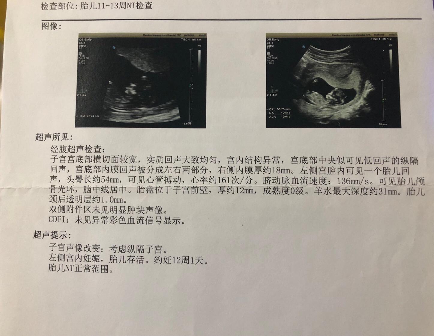 孕妈们必看孕检全攻略,医生关于孕中期的建议