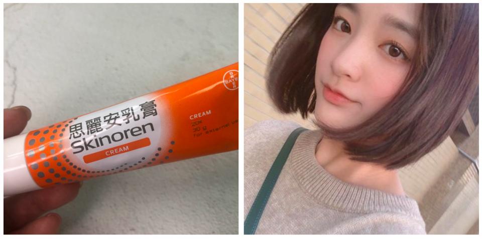 女明星分享3款药品等级的药膏、药水，紧急舒缓皮肤不适、止痒