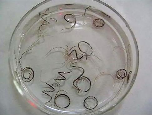 2014寄生虫事件,2006年北京福寿螺寄生虫事件