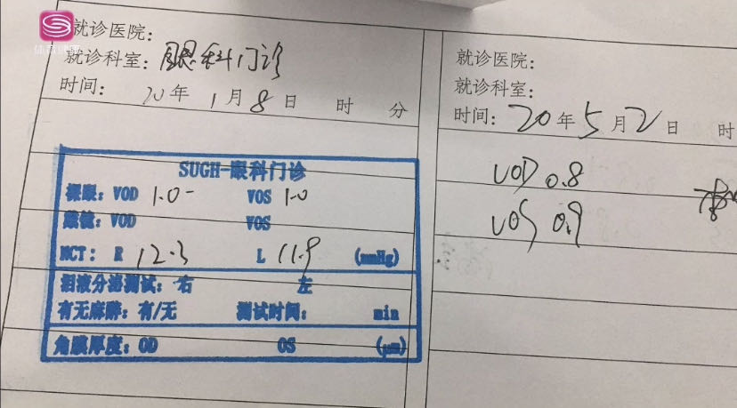 激光近视手术两眼视力不一致,激光近视手术视力回退