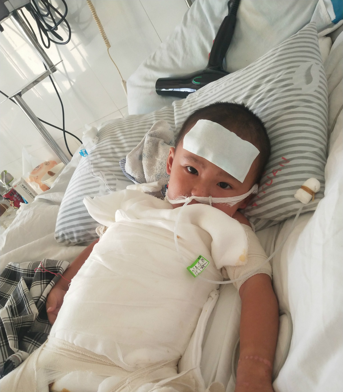 小孩被烫伤妈妈求助好心人,4岁女童重度烫伤父母含泪求助