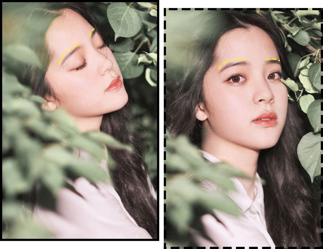 花10万打玻尿酸经验总结,花了将近十万打玻尿酸没有效果