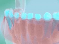 小孩乳牙没有掉要去医院拔牙,恒牙出来多久了乳牙未掉需要拔牙