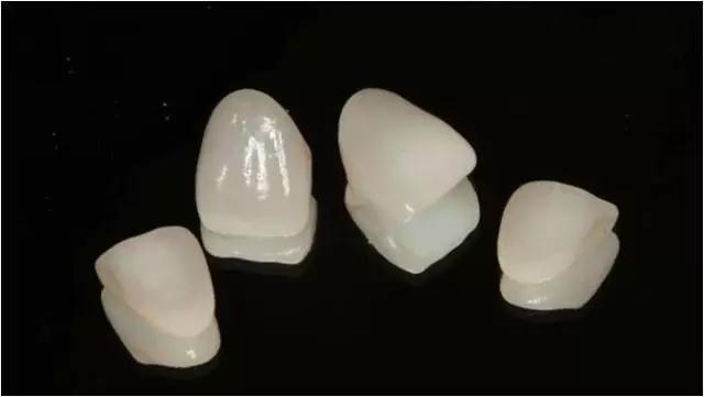 两门牙中间的缝隙越来越大,为什么门牙缝隙大这么难看