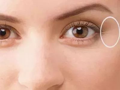 鼻子长痘是胃不好吗,鼻子长痘是肝火还是胃火