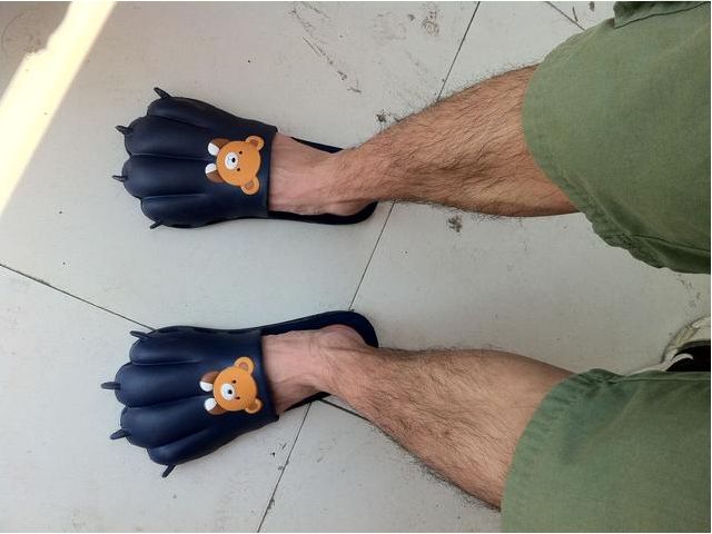 腿部出现血管明显怎么回事,腿部血管有什么反应