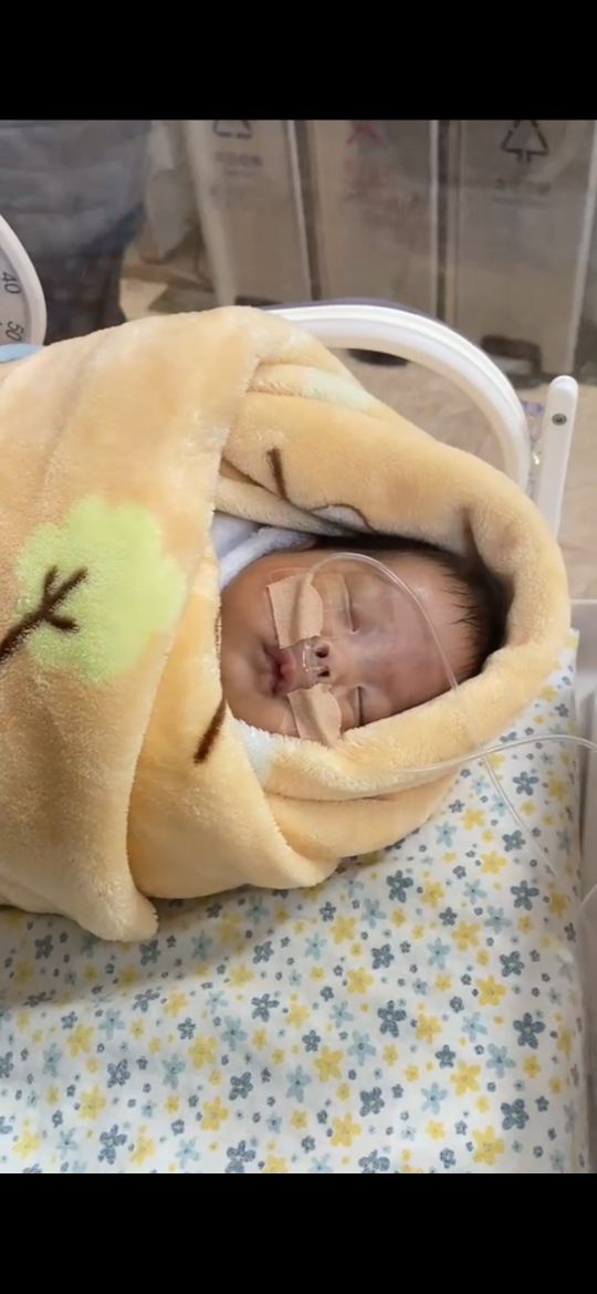 27周双胎早产大概有多少斤,27周双胎早产宝宝花费要多少