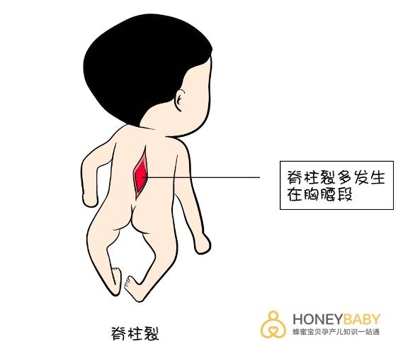 孕期食谱孕早期饮食全知道,怀孕1-3个月孕期营养食谱