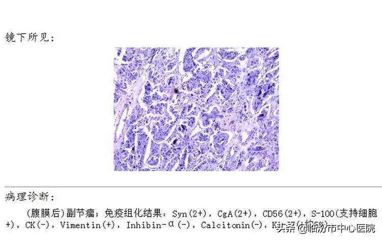 临汾市中心医院手术,临汾市中心医院腹腔镜手术