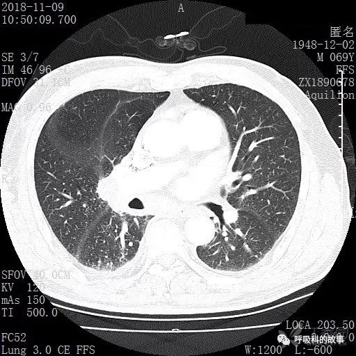 怎么应用统计学做调查,统计学方法可以解决的主要问题