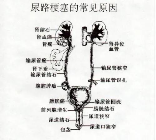 女人突然尿频尿痛尿血,突然尿血尿频尿疼是怎么回事