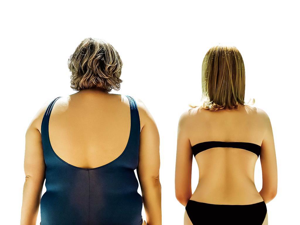 中医如何辨证肥胖,中医减肥怎样判断肥胖类型