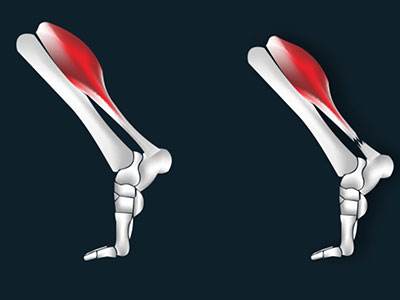 跟腱断裂怎么判断伤残,用什么方法判断跟腱断裂症状