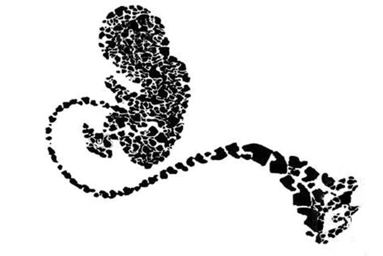 脐带血储存骗局,脐带血骗局投诉哪里