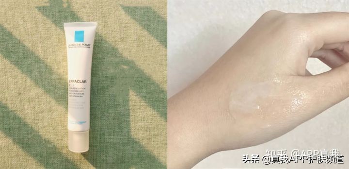 原来长痘痘有这么多的烦恼,长痘痘到底有多烦恼