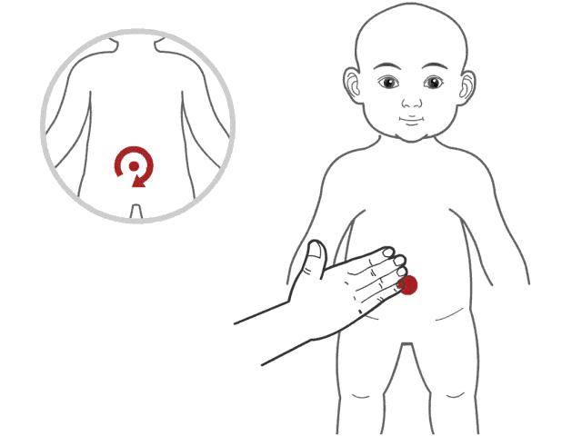 孩子又积食了，孩子一直积食怎么办？