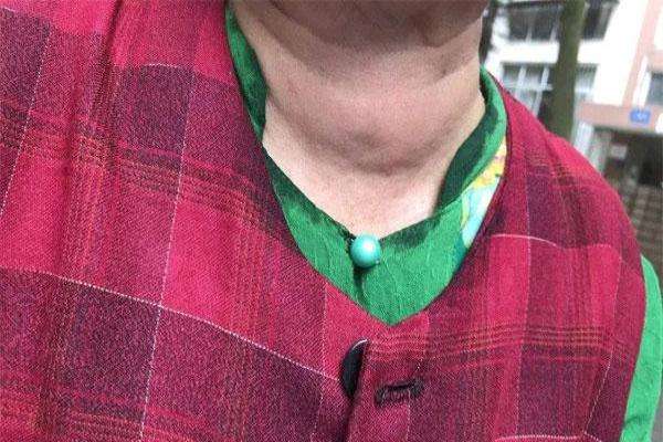 甲状腺结节4a吃什么食物可以消除,甲状腺疾病患者这些食物要适量吃