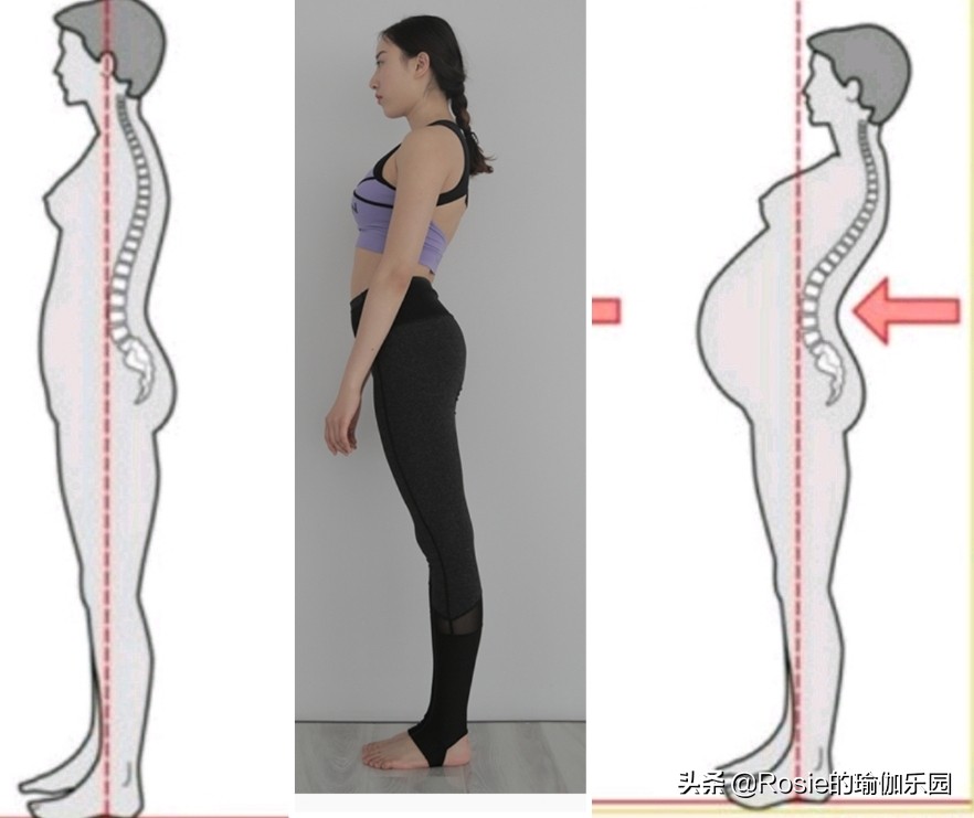 如何知道是真翘臀还是假翘臀,真翘臀和假翘臀是怎么判断的