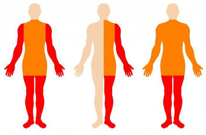 截瘫患者照顾,专业护理瘫痪老人