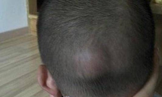 宝宝磕到头去医院查什么,小孩不小心磕到头一定要去医院吗