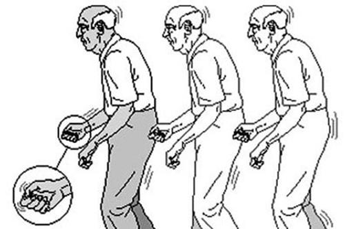 帕金森病非运动症状治疗推荐,帕金森运动障碍怎么吃药