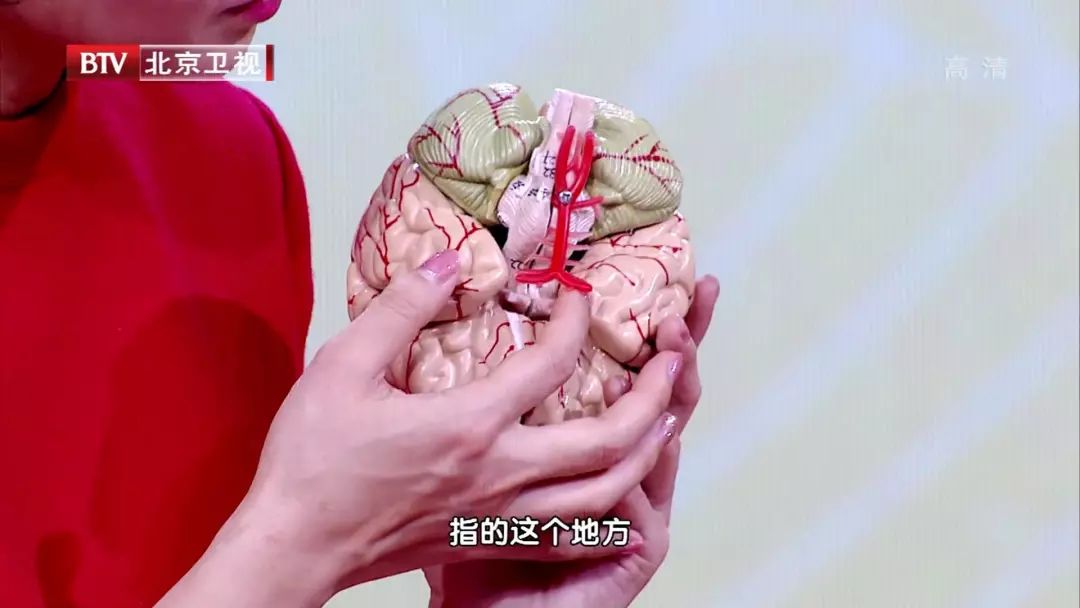 颈动脉有斑块五个办法解决,颈动脉斑块怎么办应该注意什么