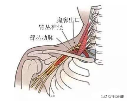 周围神经卡压解剖与分析,腓浅神经卡压解剖视频