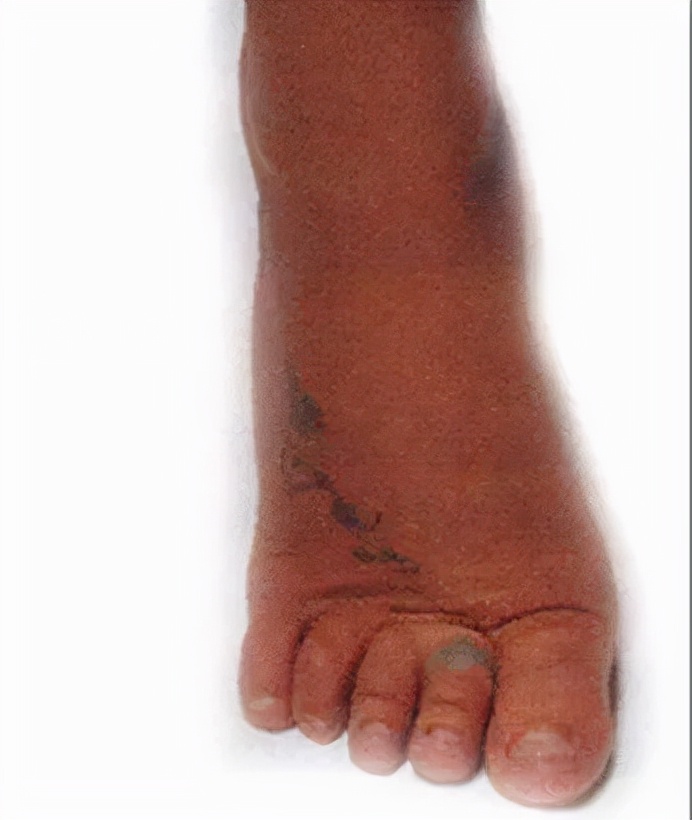 女明星的小脚趾太难了，很多走红毯的时候就被丢了