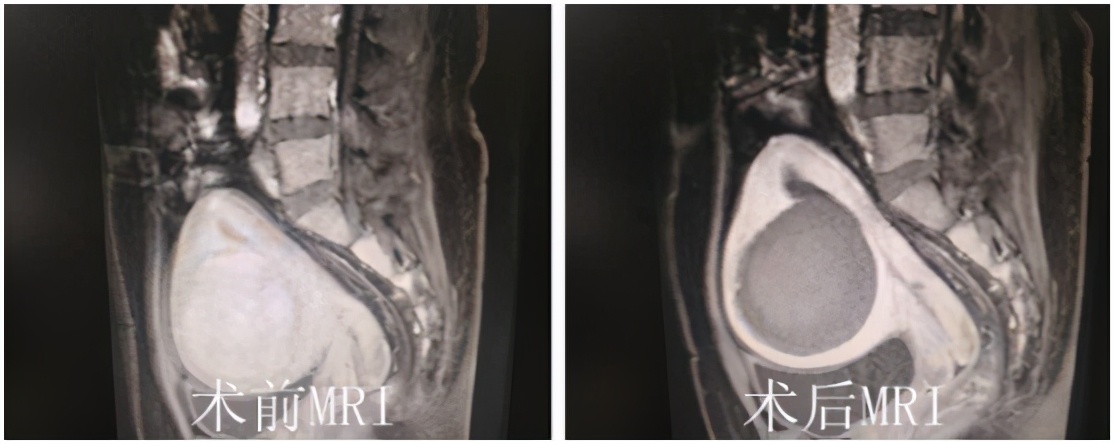 海扶刀的缺点是什么,海扶刀背后的真相视频