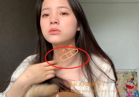 欧阳娜娜被抓,欧阳娜娜被蜜蜂蜇要去医院