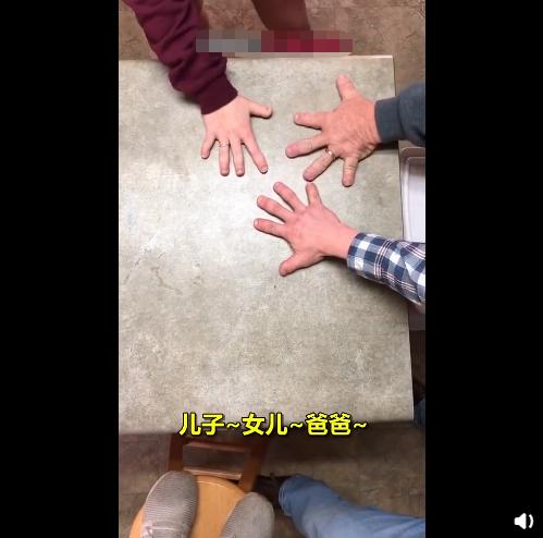 当你真的有了童话一样的小手，网友：那你可能不能挖鼻孔了