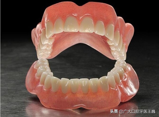 假牙哪种材料戴起来舒服,假牙挑选