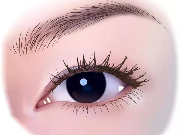 日常生活中眼睛发生肿胀，应如何解决？下面这三方面要注意！