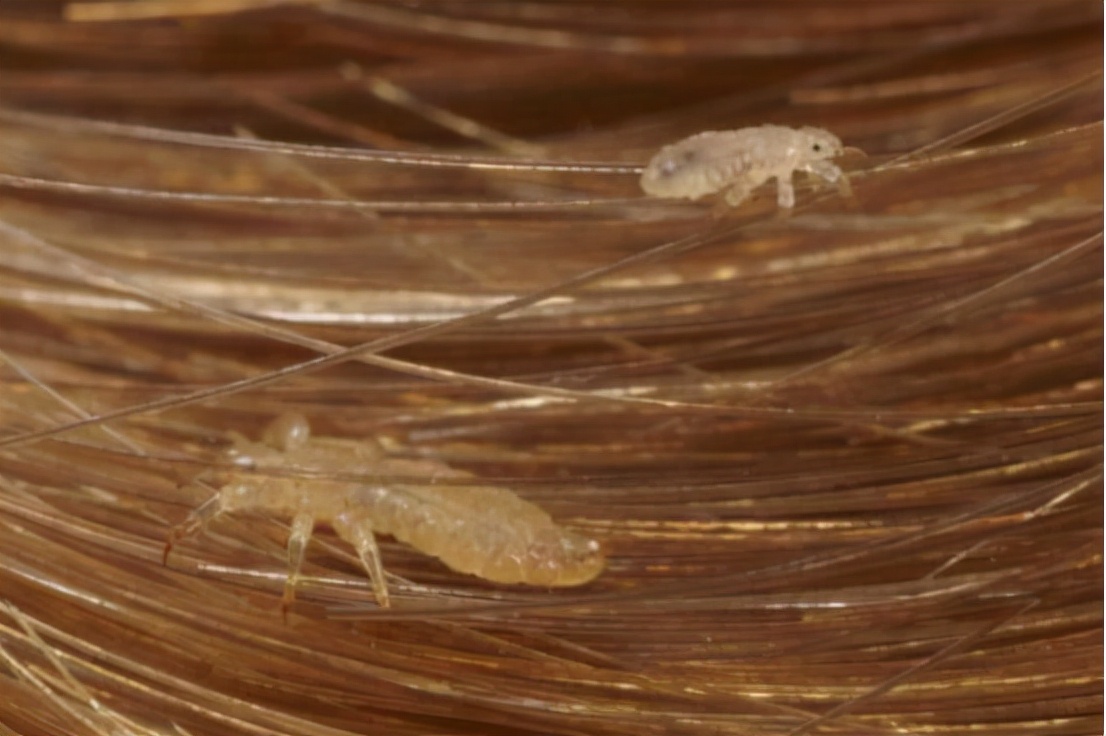 30年前的虱子现在怎么消失了,30年前人为什么都有虱子