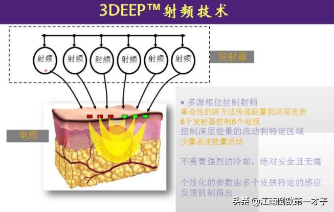 为什么射频消融术后容易复发,为什么射频消融术不除根