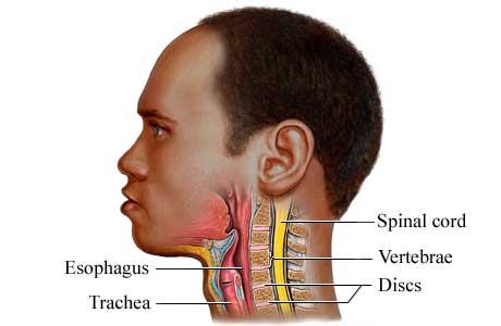 吞咽有梗阻感是食道癌,吞咽感觉有异物感是食管癌